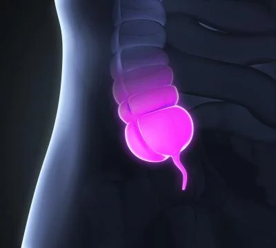 Appendix Pain Illustration Stock Illustration