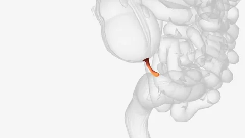 The appendix is a small pouch attached to the end of the large intestine Stock Footage 271031454