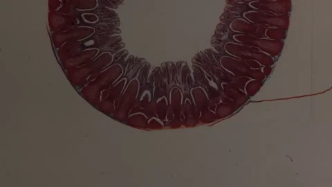Appendix transverse in close up Stock Footage 292140675