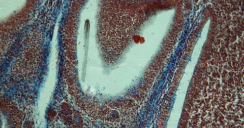 Appendix transverse Stock Footage 144747790