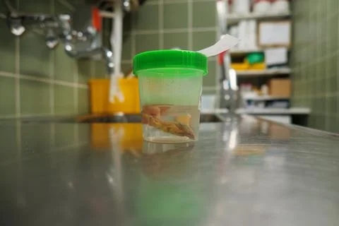 An appendix was placed in formalin in a preparation pot Stock Photos
