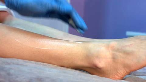 Application of the cream on a foot Stock Footage 68414501