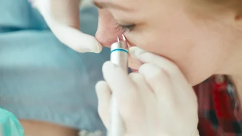 Application of the laser pen to the site of vascular network formation. Stock-Footage 272472566
