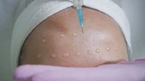 Application of oil on forehead. Girl does anti-aging facial skin massage  Stock Footage 120577874
