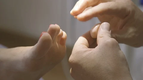 Application of silicone implant on a foot Stock Footage 87450243