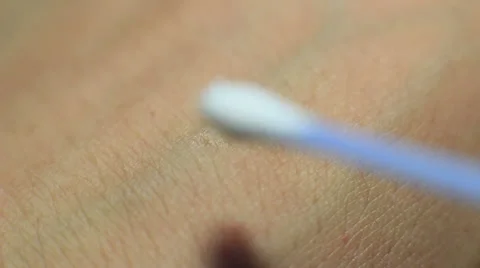 Applied ointment on the skin Stock Footage 37822406