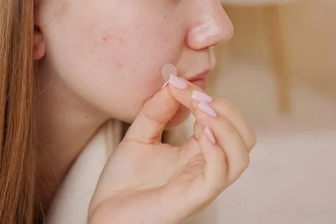 Applying Acne Patch for Skin Care Treatment Stock Photos