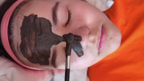 Applying black clay in the form of a mask on the problematic skin of a teenager Stock Footage 241009855