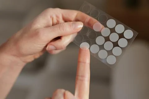 Applying Hydrocolloid Acne Patch On Finger Skincare Treatment Closeup 스톡 사진