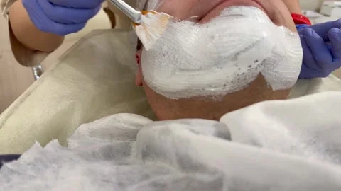 Applying a lifting mask to a man's face Stock Footage 244083504