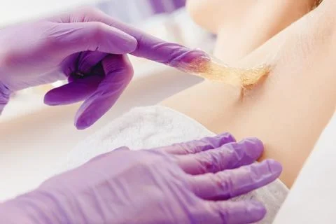 Applying liquid sugar paste to depilation underarm skin woman. Sugaring beauty Stock-Fotos