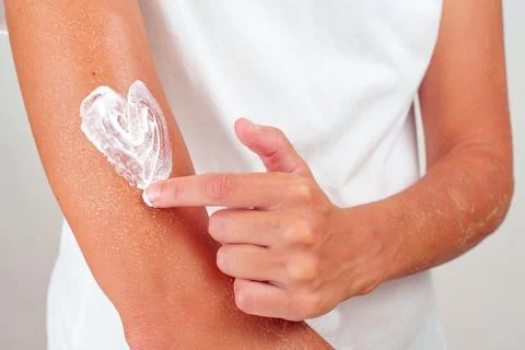 Applying Moisturizer in Heart Shape on Arm Having Dry and Flaky Skin Stock Photos