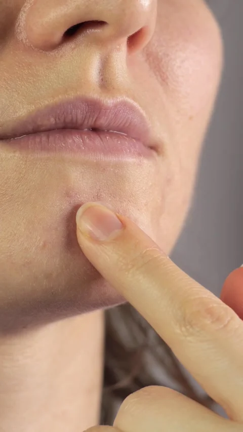 Applying patches Stock Footage 311862829