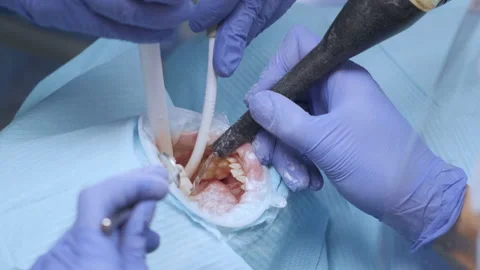 Applying resin based composite filling on tooth. Young woman at dental clinic Stock Footage 138064431
