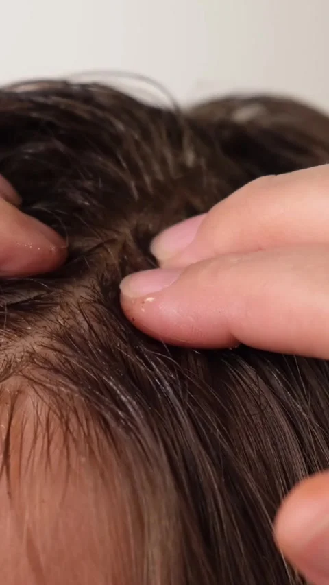 Applying scrub and scrubbing and massaging scalp close-up, hair care Stock Footage 311795170