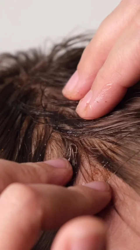 Applying scrub and scrubbing and massaging scalp close-up, hair care Stock Footage 312645125