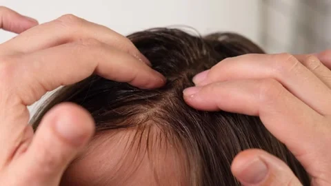 Applying scrub and scrubbing and massaging scalp close-up, hair care Stock Footage 312674107