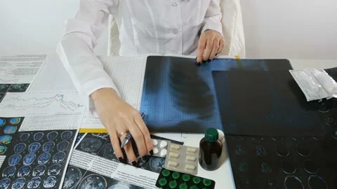 Appointment of medicament Stock-Footage 87264360