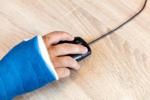 Arm with cast 스톡 사진