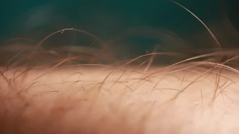 Arm hairs extreme close up Vídeos de archivo 86509530