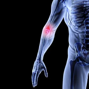 Arm Stock Illustration