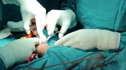 Arm surgery. Surgeons team performing operation arm in operating room.Tilt up. 스톡 동영상 34927459