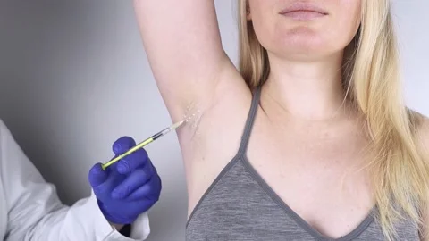 Armpit injection botulinum toxin. Cream marking for injection sites. Pain relief Stock Footage 169988728