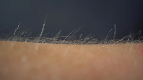 Arms Hairs Standing Up, Macro Stock Footage 92763628
