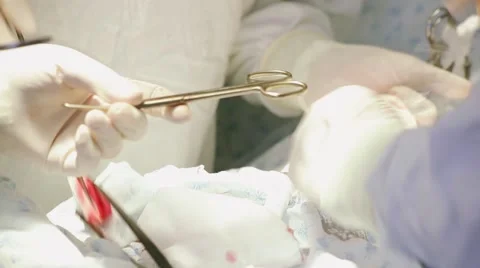 Arms of the operating surgeon Stock Footage 60798595