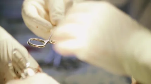 Arms of the operating surgeon Stock Footage 60798599