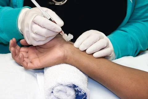 Arterial puncture Stock Photos