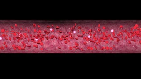 Artery blockage simulation. Video stock 10734053