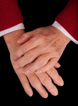 Arthritic hands Stock Photos