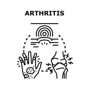 Arthritis disease causing joint pain and inflammation Stock Illustration
