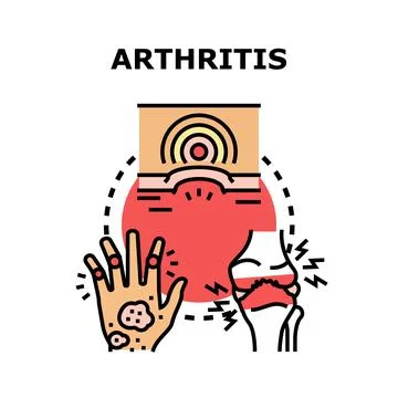 Arthritis disease causing joint pain and inflammation Stock Illustration