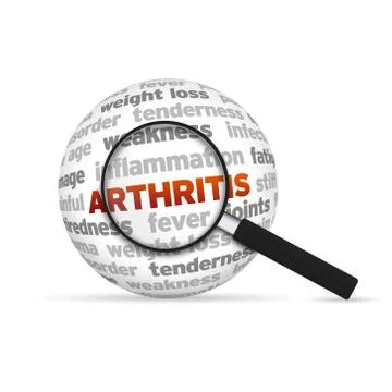 Arthritis Illustrazione stock