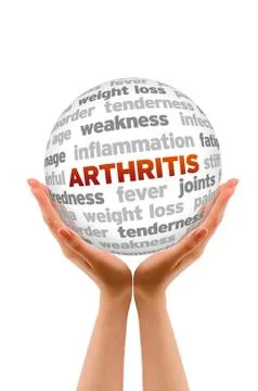 Arthritis Stock Illustration