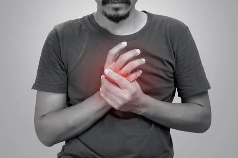 Arthritis. Foto stock