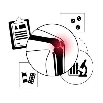Arthritis poster concept Illustrazione stock
