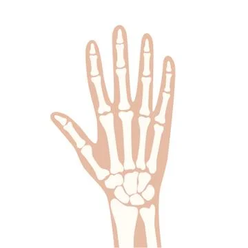Arthrits x ray Stock Illustration
