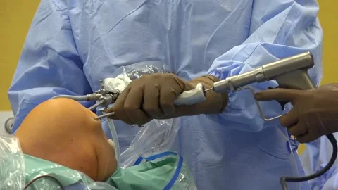 Arthroscopy and Knee Ligament Surgery in the hospital Stock Footage 239583166