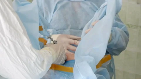 Arthroscopy on the knee, sterile operating room, close-up 1 動画素材 68414320