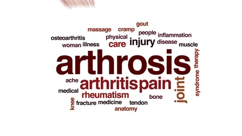 Arthrosis animated word cloud, text design animation. Stock Footage 79585148