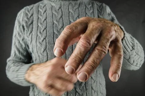 Arthrosis of the joints. Close-Up Stock Photos