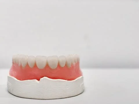 Artificial denture of human teeth of lower jaw Fotos Stock