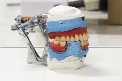 Artificial dentures in the manufacturing steps Stock Photos