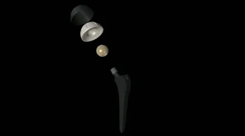 Artificial Hip - endoprosthesis Stock Footage 21240245