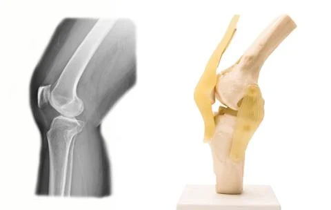 Artificial human knee joint model in medical Stock Photos