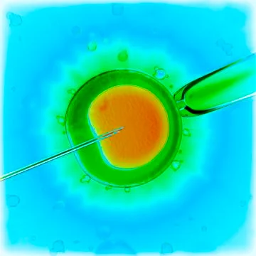 Artificial insemination Stock Illustration