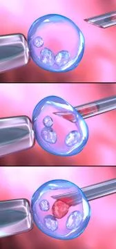 Artificial insemination process Illustrazione stock